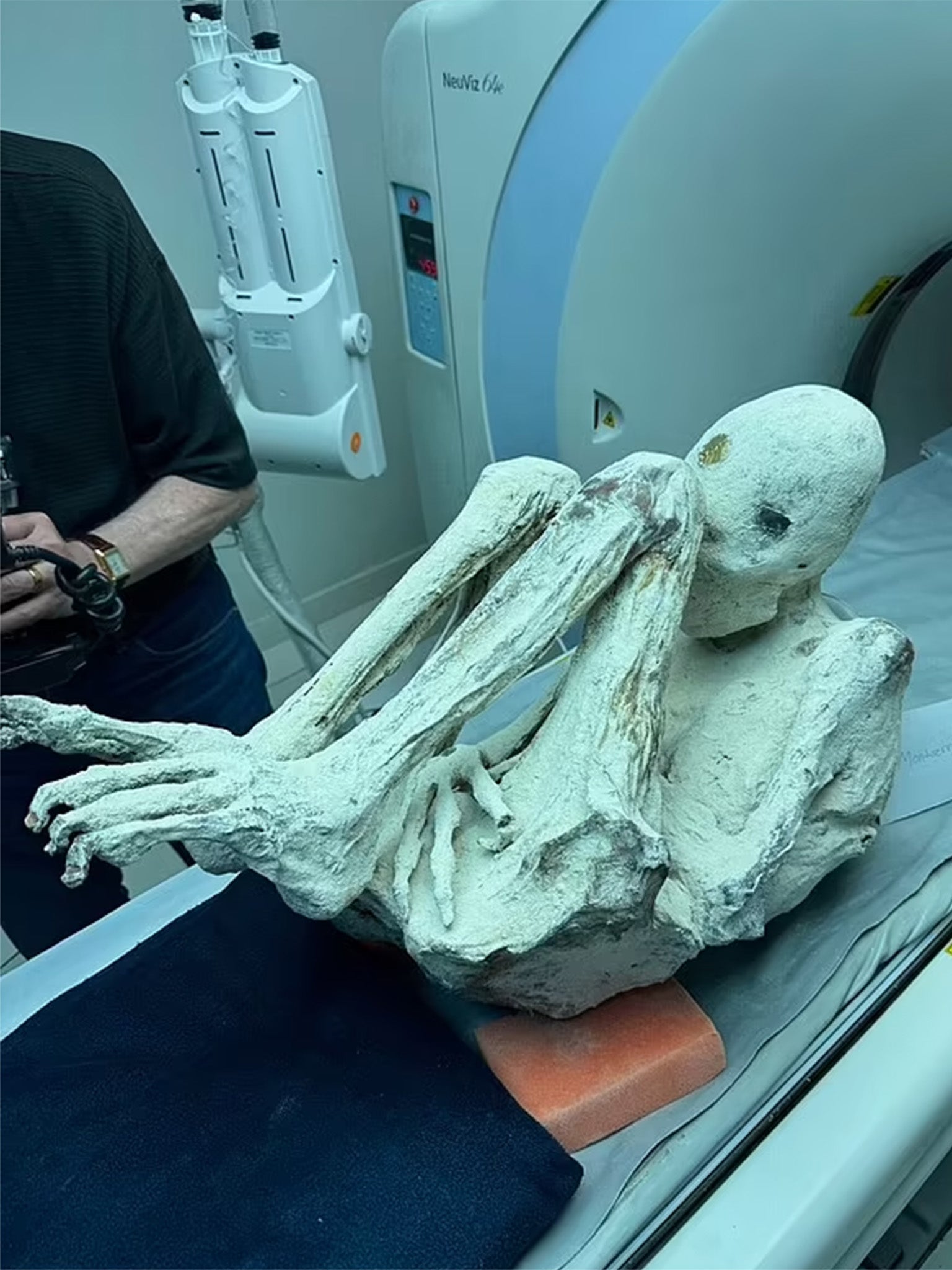 Bizarre Case Of Peru Alien Mummies Takes Another Turn As Officials Raid ...